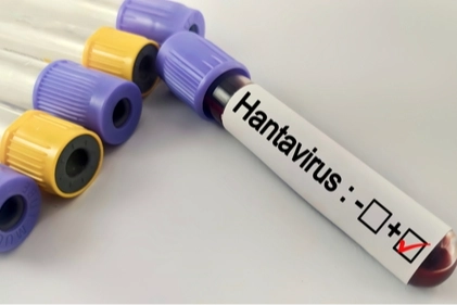 Hantavir&uuml;s Bir Salgına D&ouml;n&uuml;ş&uuml;r m&uuml;?