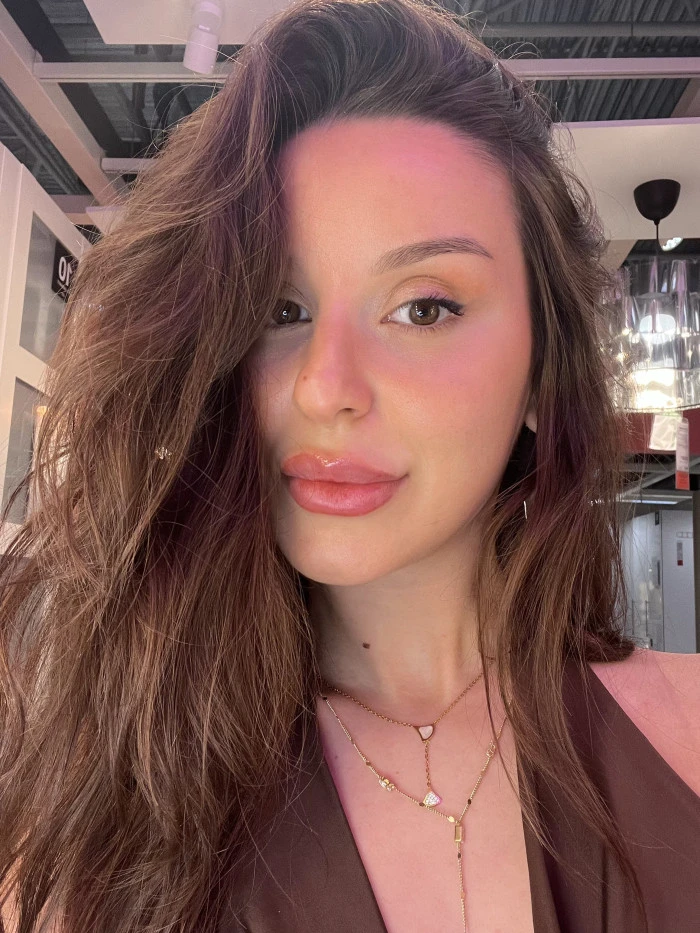 Aleyna  Ece Özdaş- Fizyoterapist